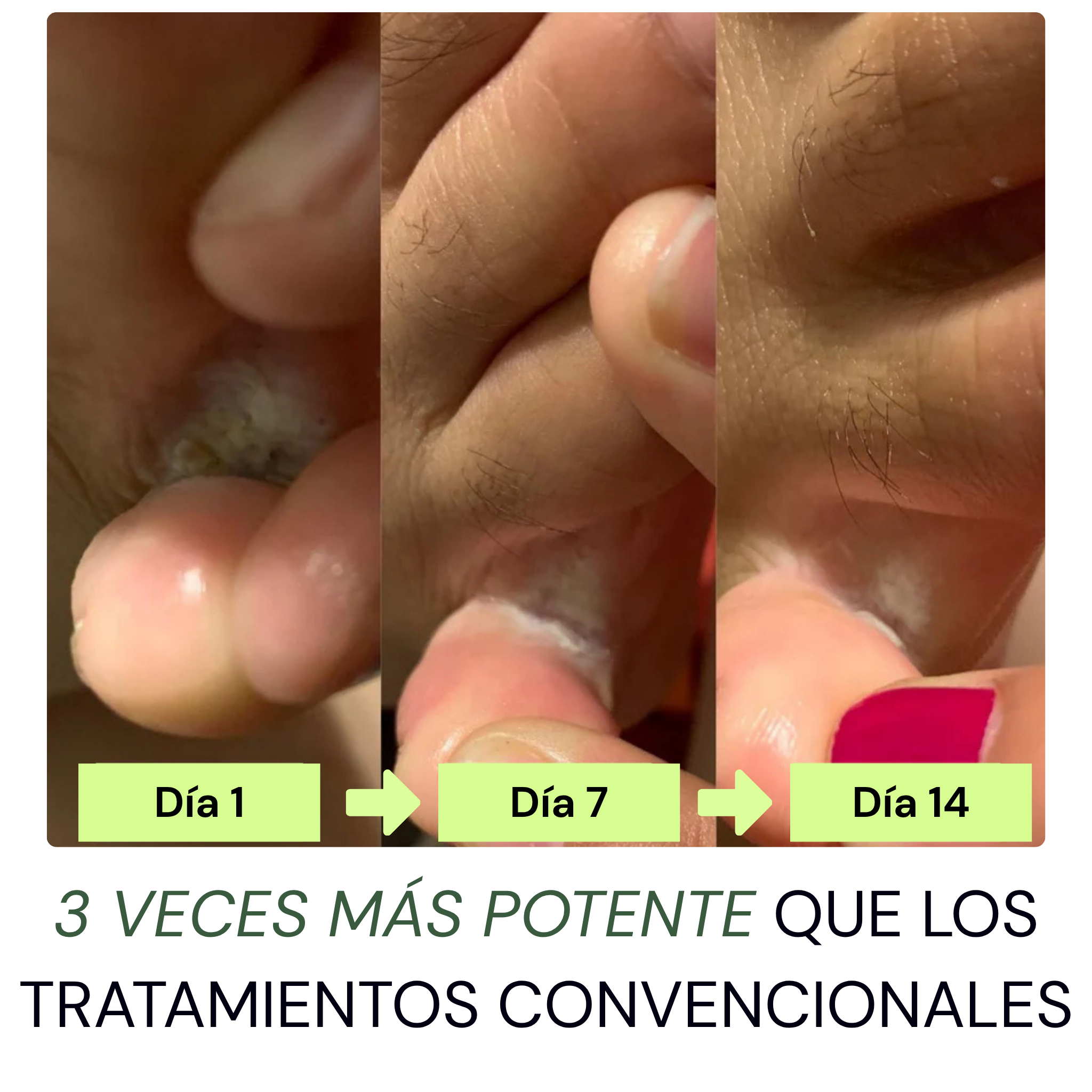 Jabón Antifúngico Luvadys