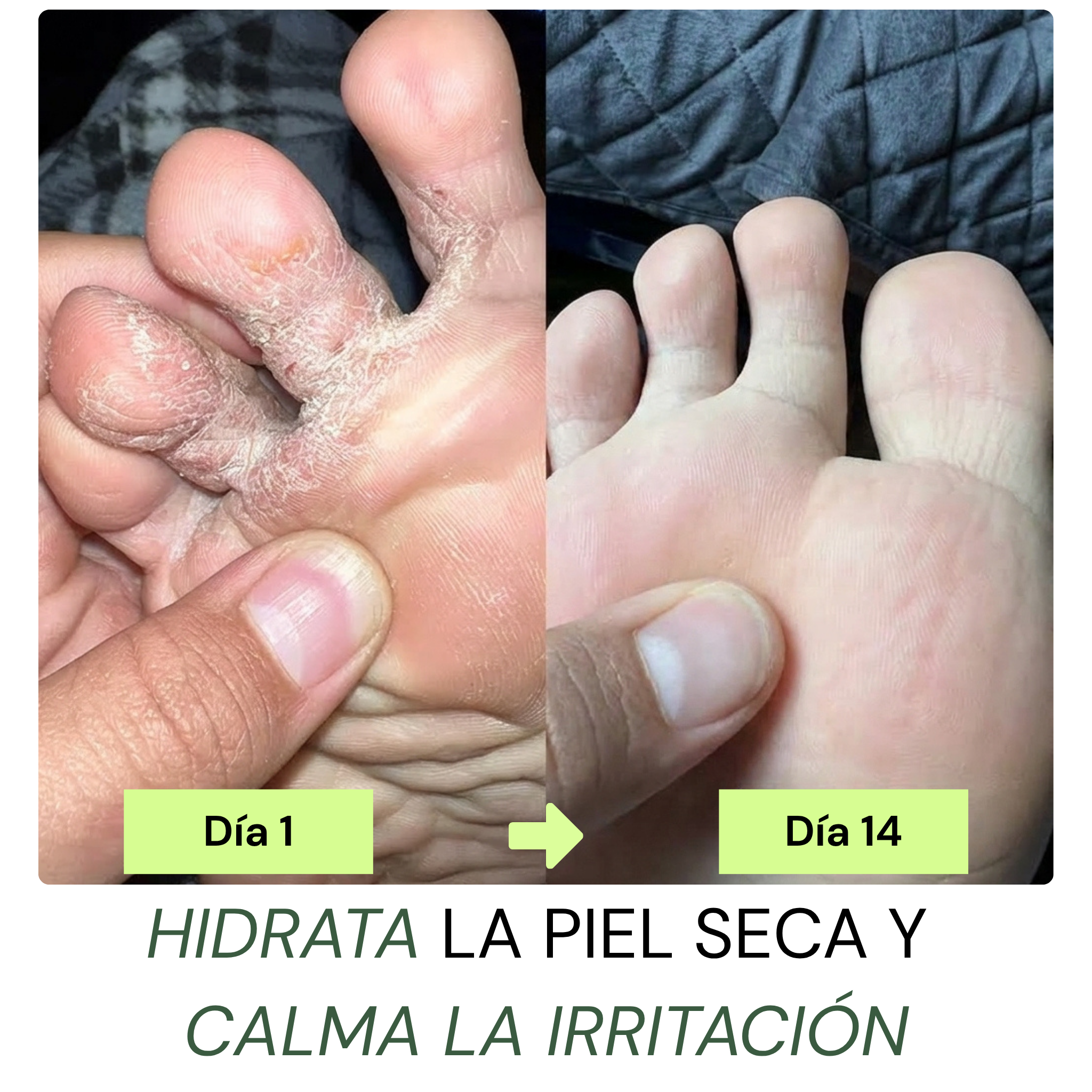 Jabón Antifúngico Luvadys